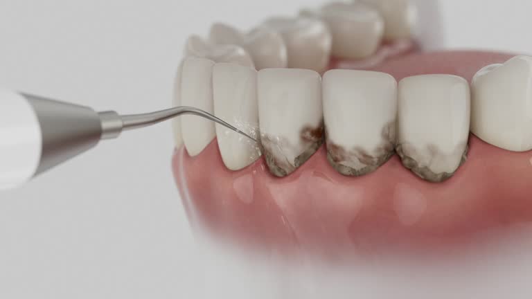 Reliable Dental Implants contractor in Bristol Bay Borough County, AK by Dentist Open Now